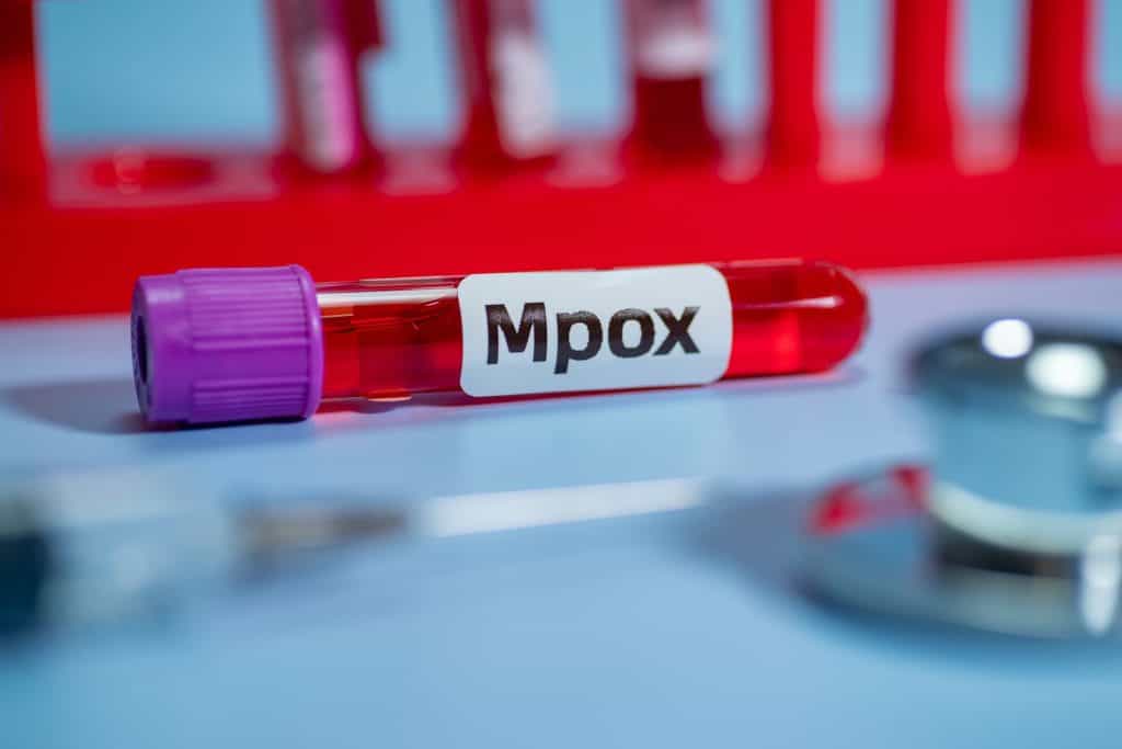 Tubo com sangue e adesivo escrito "mpox"