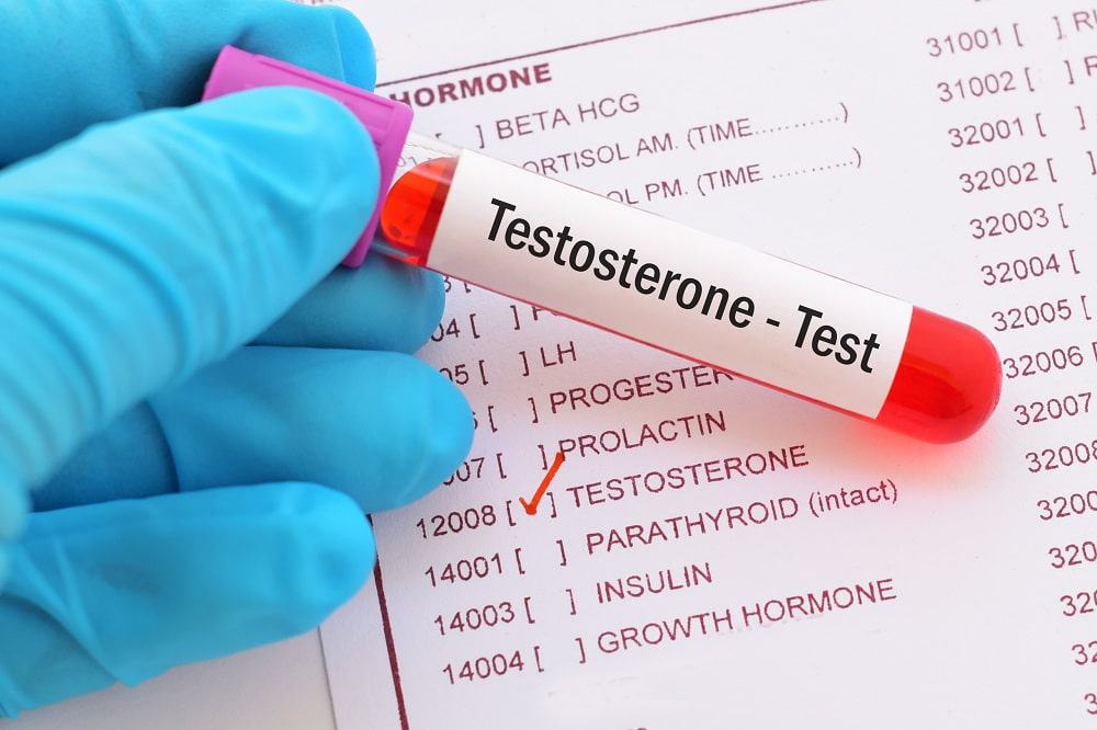 médico segura teste de testosterona