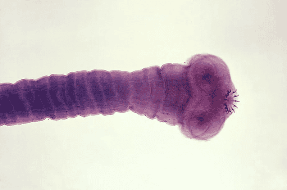 imagem mostra um close up de uma captura microscópica do bicho do corpo: o parasita Taenia solium