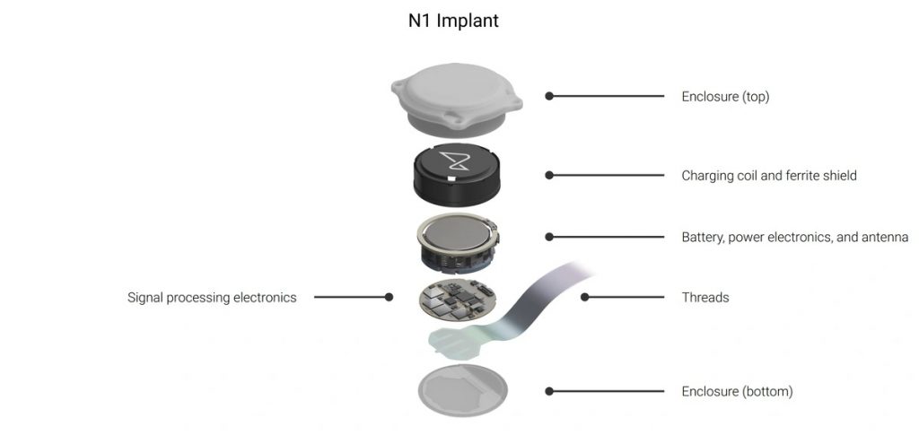 implante n1 da neuralink
