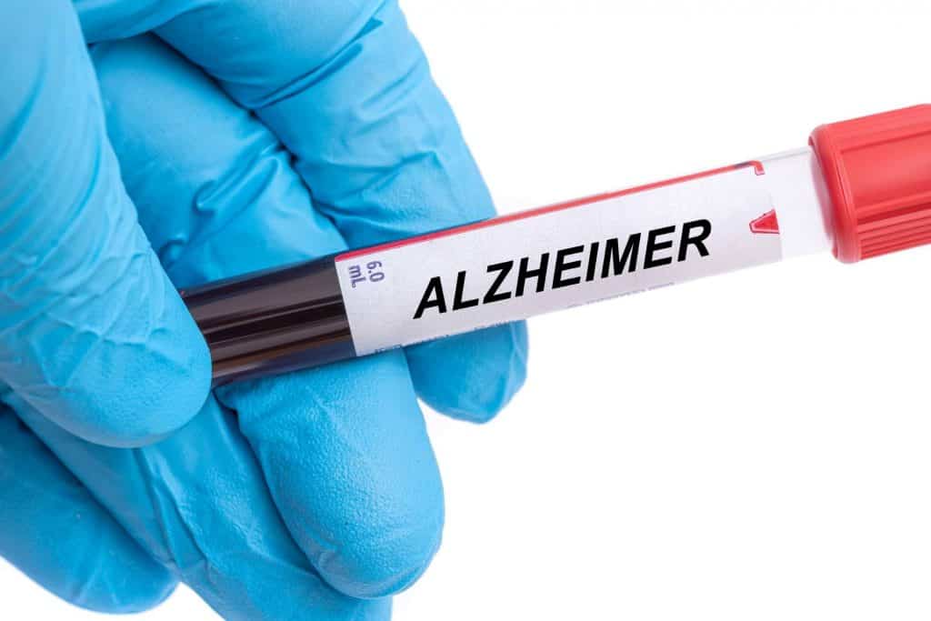 doença de alzheimer
