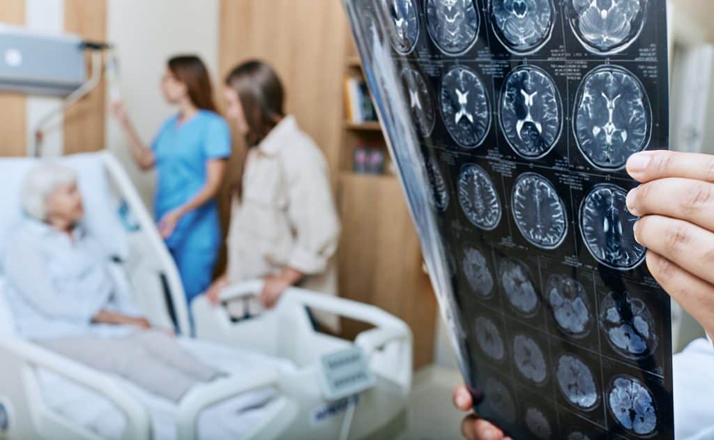 Pessoa acamada com duas mulheres olhando-a em pé e, à frente, um médico segurando exames de tomografia cerebral