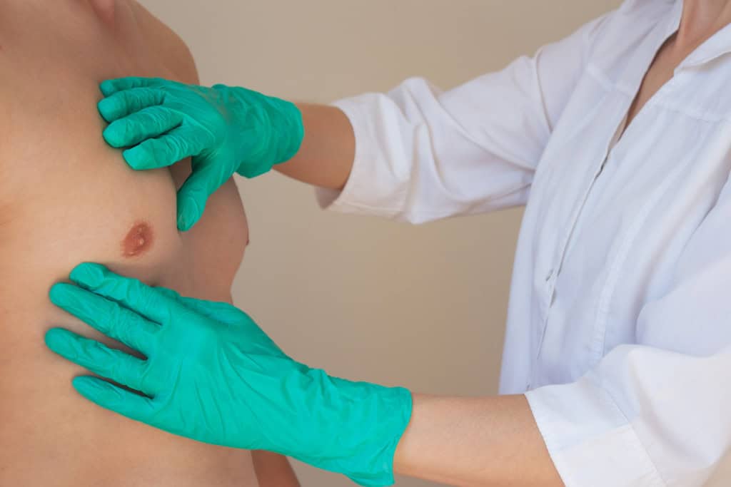 Médico analisa mama de homem para investigar câncer de mama