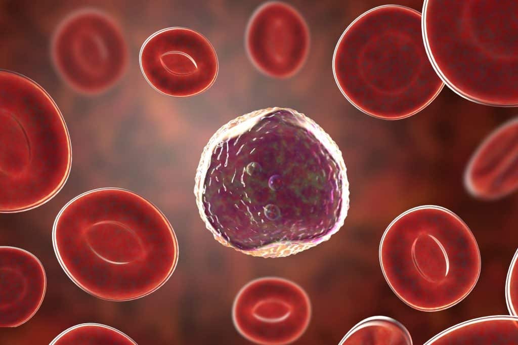 cancer sangue
