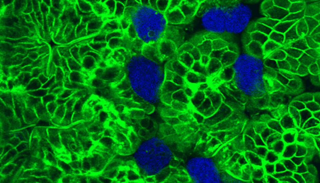 Entamoeba histolytica