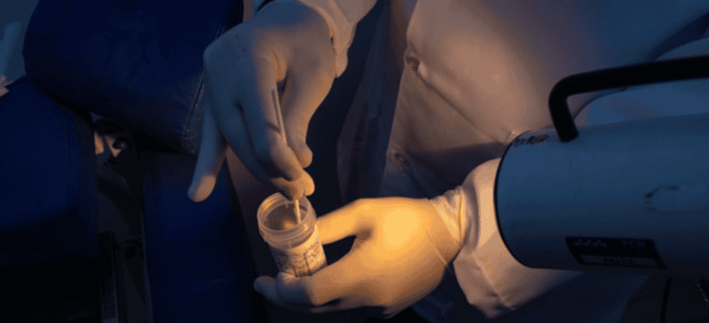 novo exame hpv sus