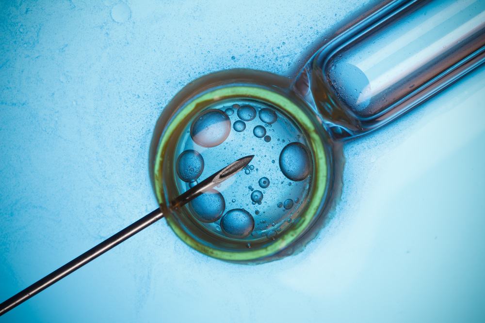 Um óvulo sendo fertilizado em laboratório