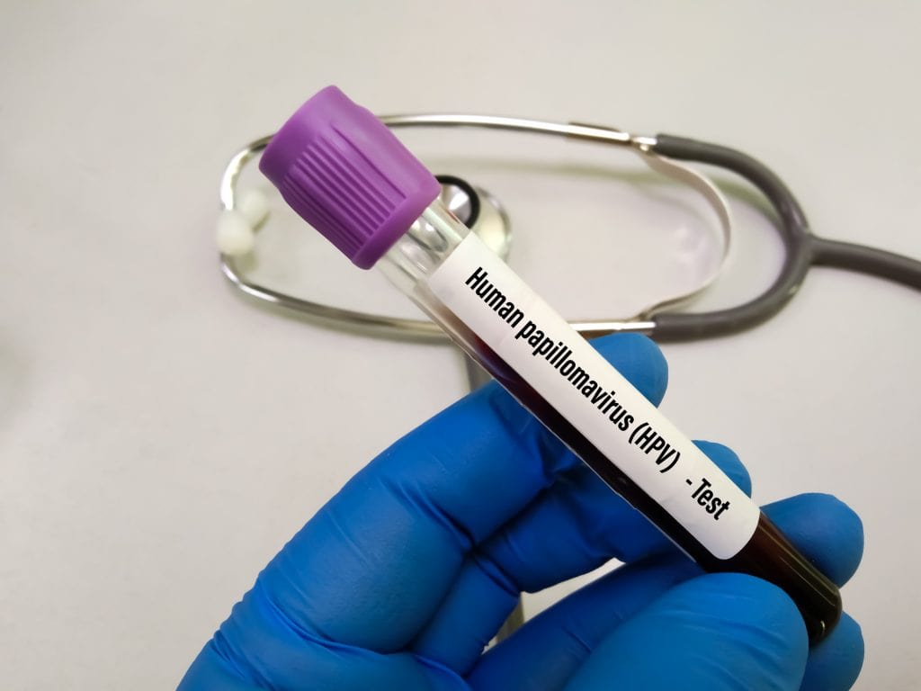 Vidro de armazenamento com etiqueta escrito o nome do HPV