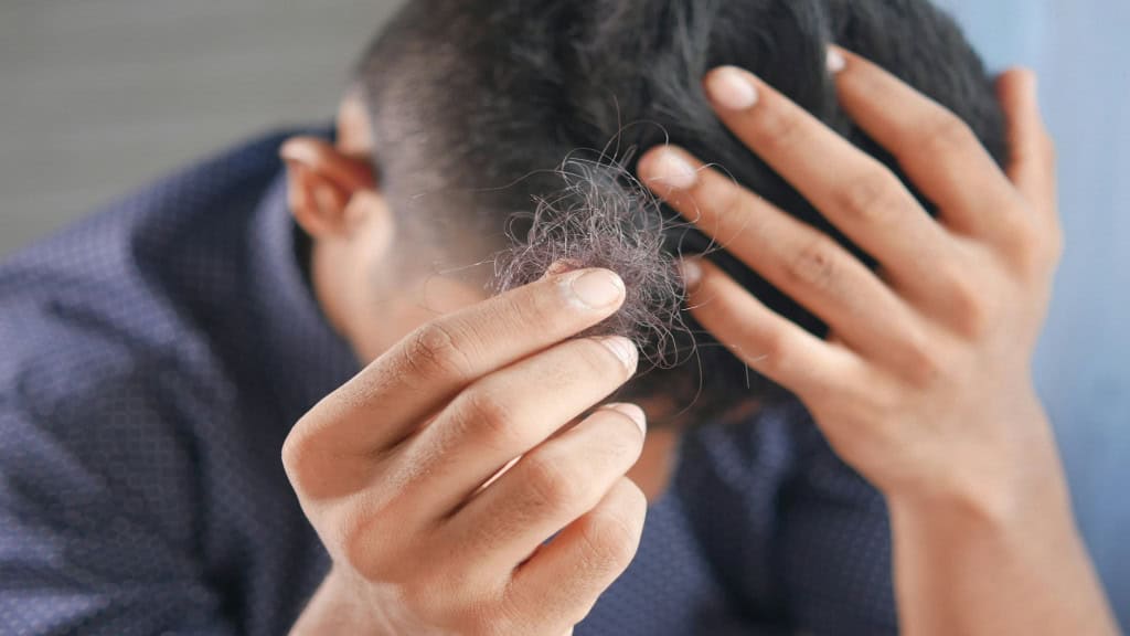 Homem segurando tufo de cabelo com uma mão e escondendo a cabeça com a outra